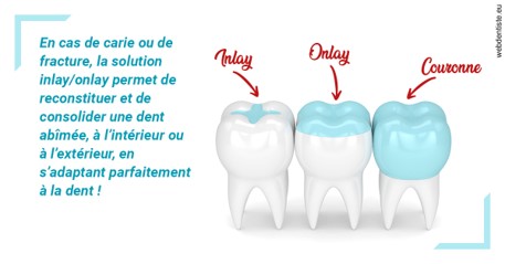 https://dr-belorgey-pierre.chirurgiens-dentistes.fr/L'INLAY ou l'ONLAY