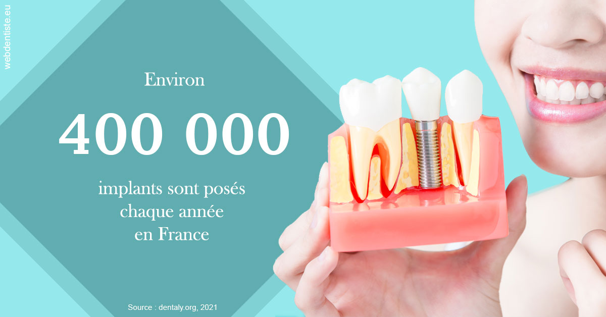 https://dr-belorgey-pierre.chirurgiens-dentistes.fr/Pose d'implants en France 2