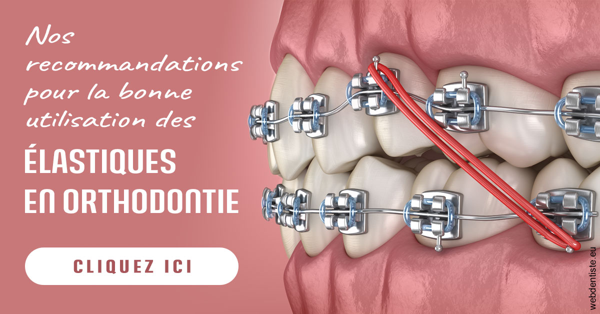 https://dr-belorgey-pierre.chirurgiens-dentistes.fr/Elastiques orthodontie 2
